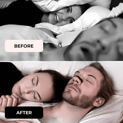 #EpisodeOne - The Next-Generation Magnetic Nasal Strip